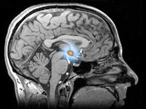 The hypothalamus is a tiny part of the brain but regulates the whole bodyâs metabolism through hormones
