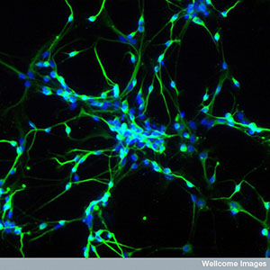 Stem cells can be used to grow neurons in the lab. These neurons are really powerful tools for studying diseases like HD.