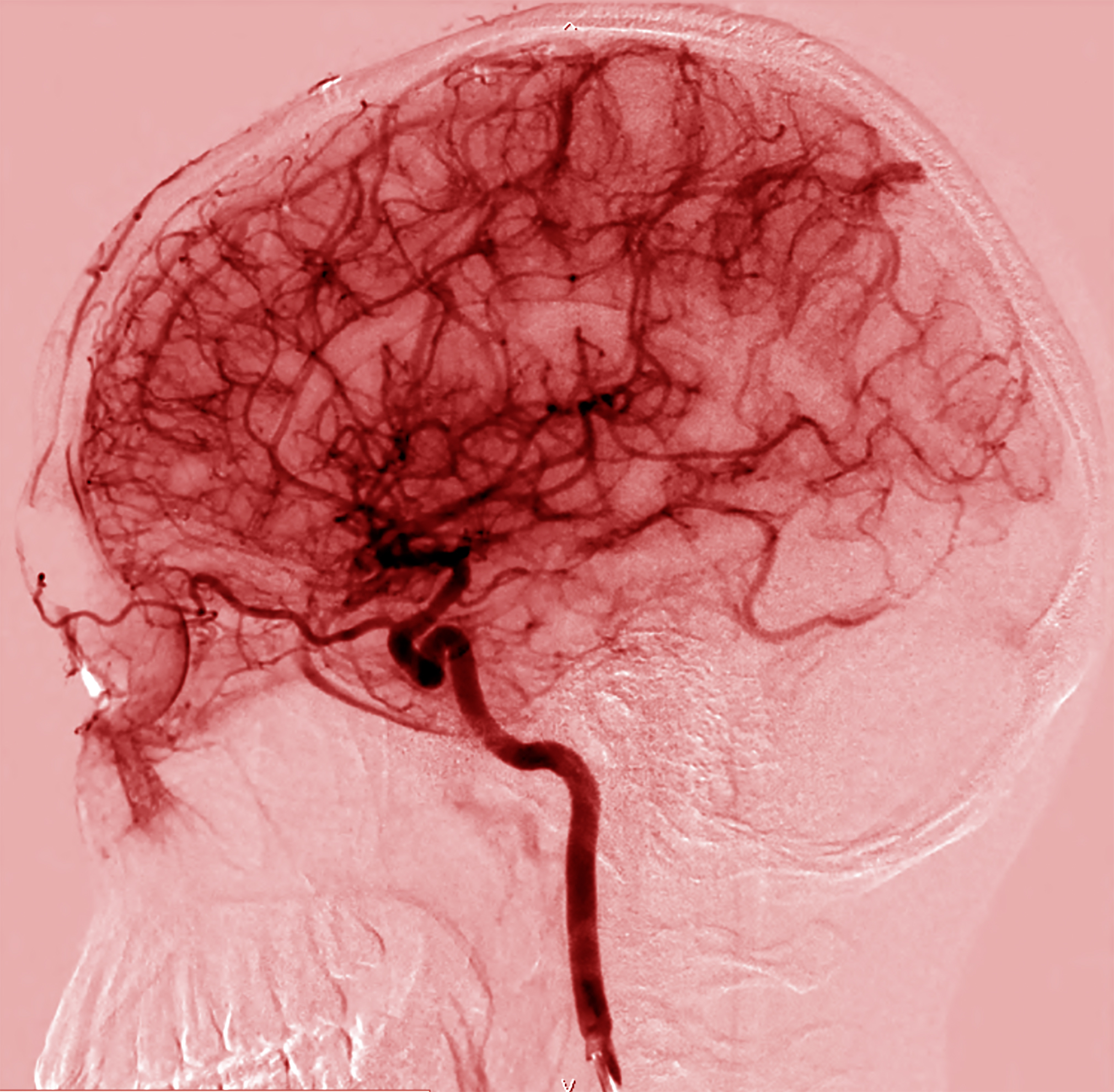 This is an image of the brainâs many blood vessels. The cells that line these vessels create the blood-brain barrier.